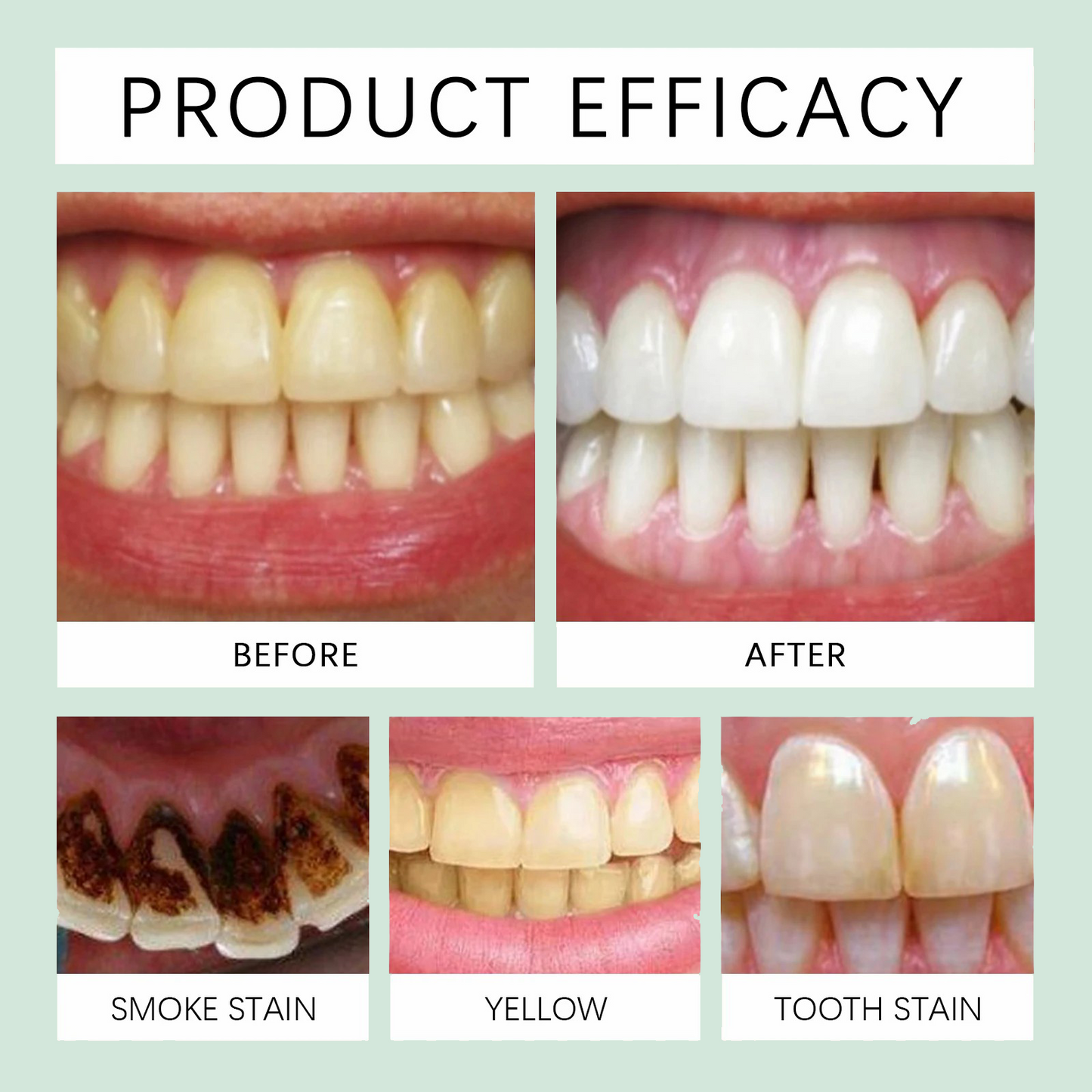 𦷠LOVILDS⢠Fluoride-Free Toothpaste with Nano Hydroxyapatite