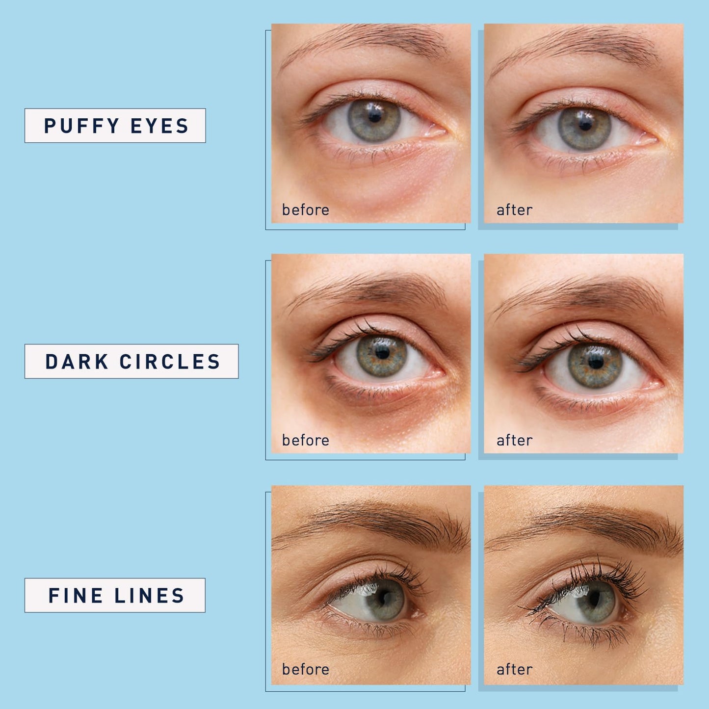 👁️ LOVILDS™ Retinol Collagen Under Eye Gels Mask (30 Pairs) - Anti-Aging Eye Treatment Pads to Reduce Dark Circles, Wrinkles, Puffy Eyes & Eye Bags