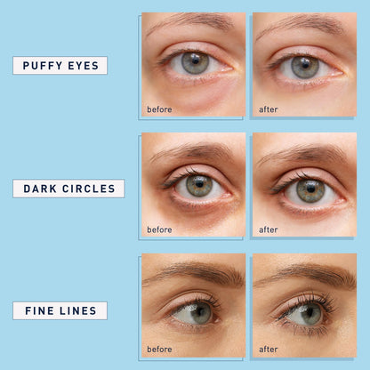 👁️ LOVILDS™ Retinol Collagen Under Eye Gels Mask (30 Pairs) - Anti-Aging Eye Treatment Pads to Reduce Dark Circles, Wrinkles, Puffy Eyes & Eye Bags