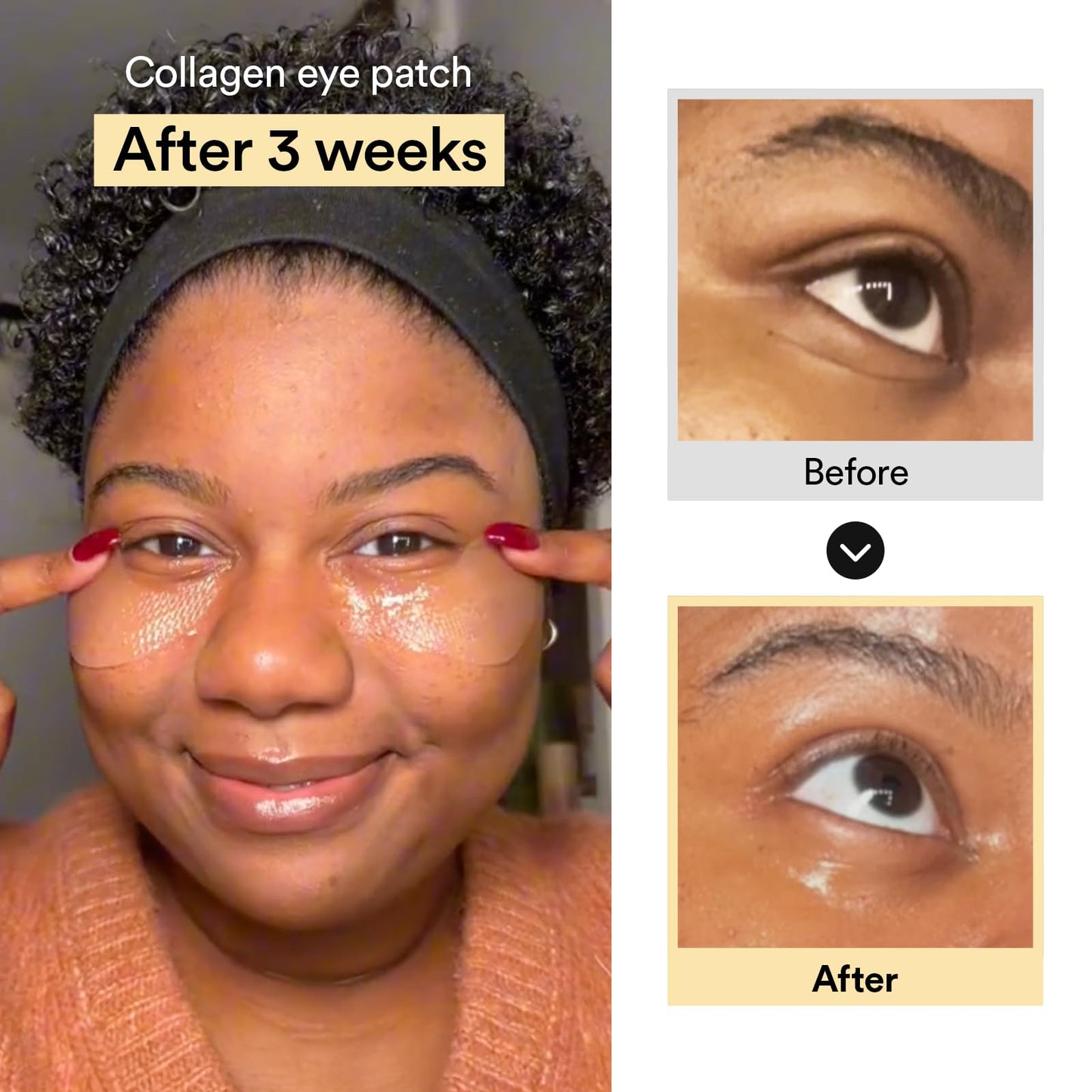 ✨ 💧 LOVILDS™ Collagen Jelly Eye Patch for Puffy Eyes & Dark Circles & Wrinkles, 60 Patches