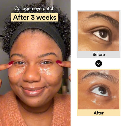 ✨ 💧 LOVILDS™ Collagen Jelly Eye Patch for Puffy Eyes & Dark Circles & Wrinkles, 60 Patches